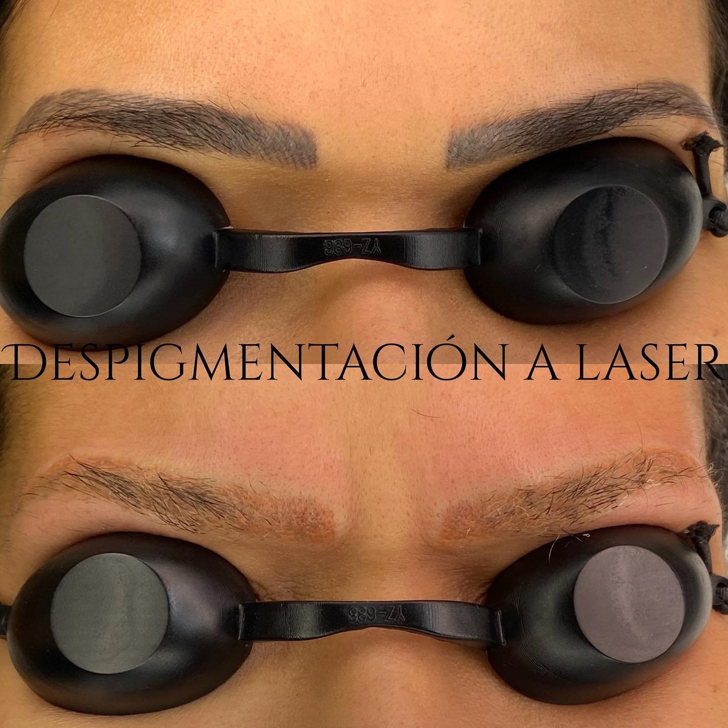 Micropigmentación Madrid, Estudio de belleza en Madrid